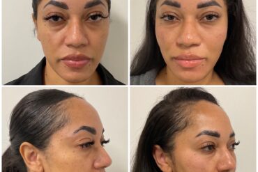 Why Eternia Medspa Is Generating Buzz